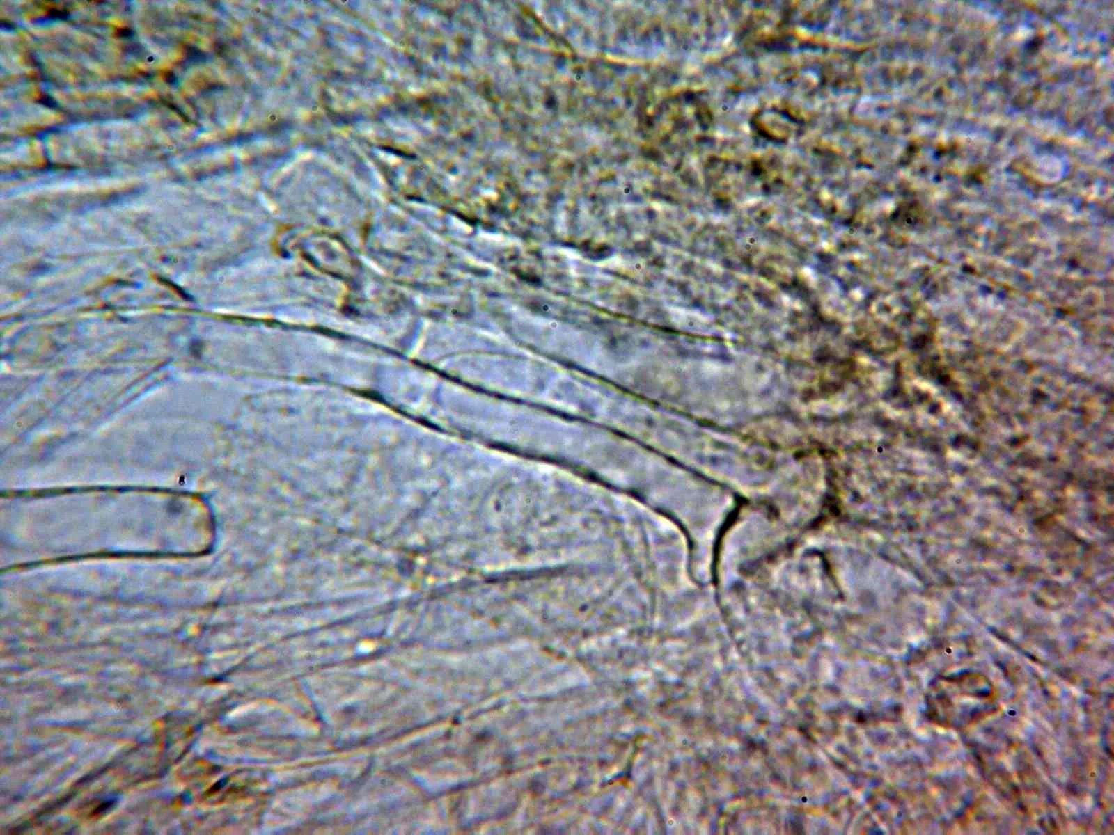 Microscopía de Leratiomyces squamosus - 10 - Pileipellis agua
